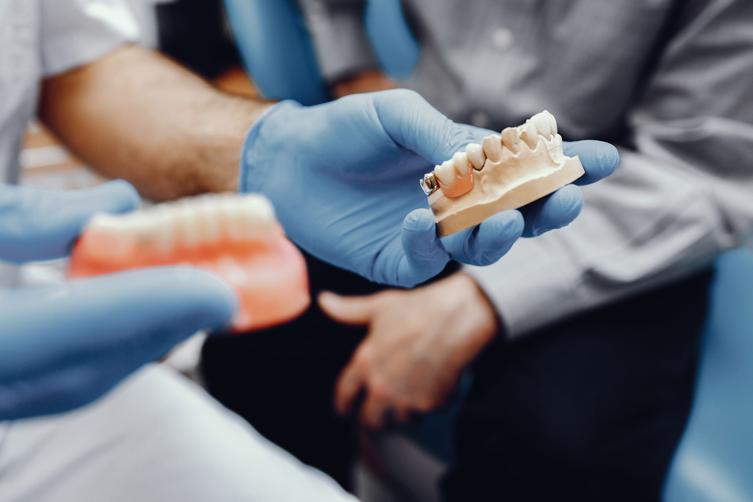Quanto tempo dura um implante dentário?