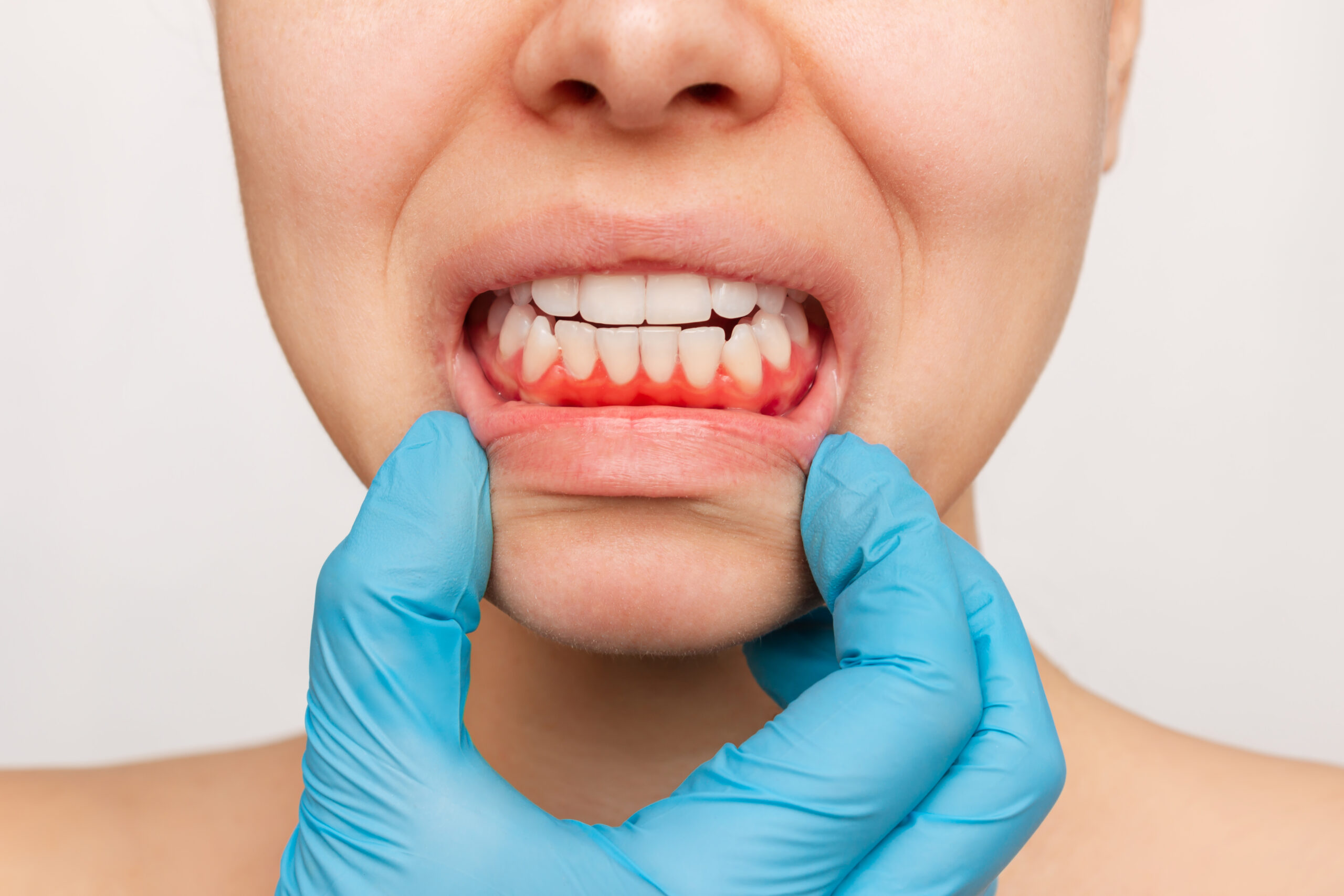 O que é periodontia?