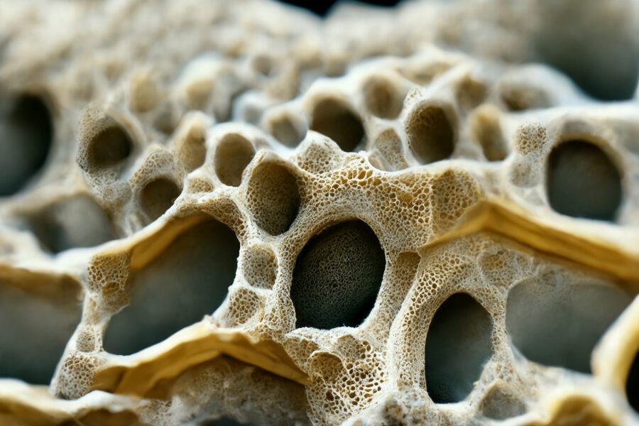 ilustração da estrutura esponjoda do osso