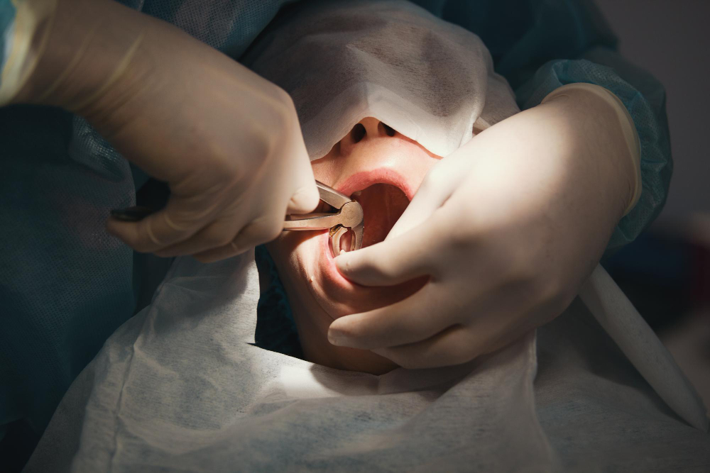 Cirurgia parendodôntica: o que é?