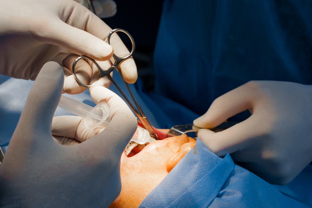 Cirurgia de enxerto ósseo: quando saber a indicação?